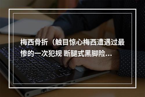 梅西骨折（触目惊心梅西遭遇过最惨的一次犯规 断腿式黑脚险些毁了他）